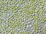 Chlorella – malý pomocník s velkým účinkem